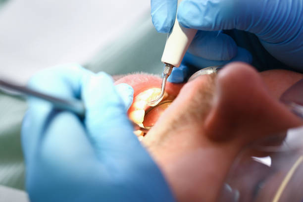 Best Cosmetic Emergency Dentistry in Stonebridge, NJ